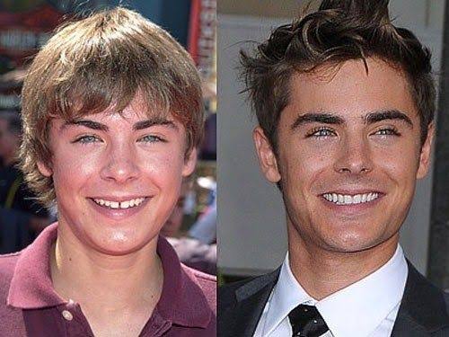 Zac Efron v dospívání a dospělosti